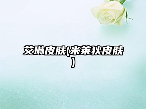 艾琳皮肤(米莱狄皮肤)